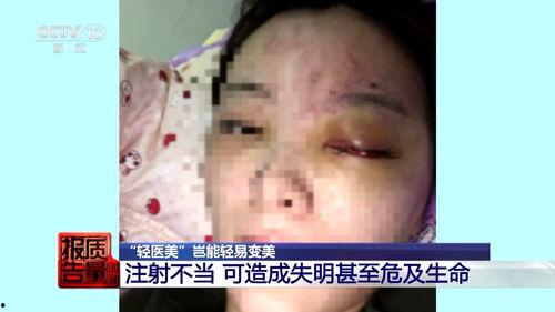 珠海医美注射事件爆料视频,揭秘美容针背后的惊悚真相